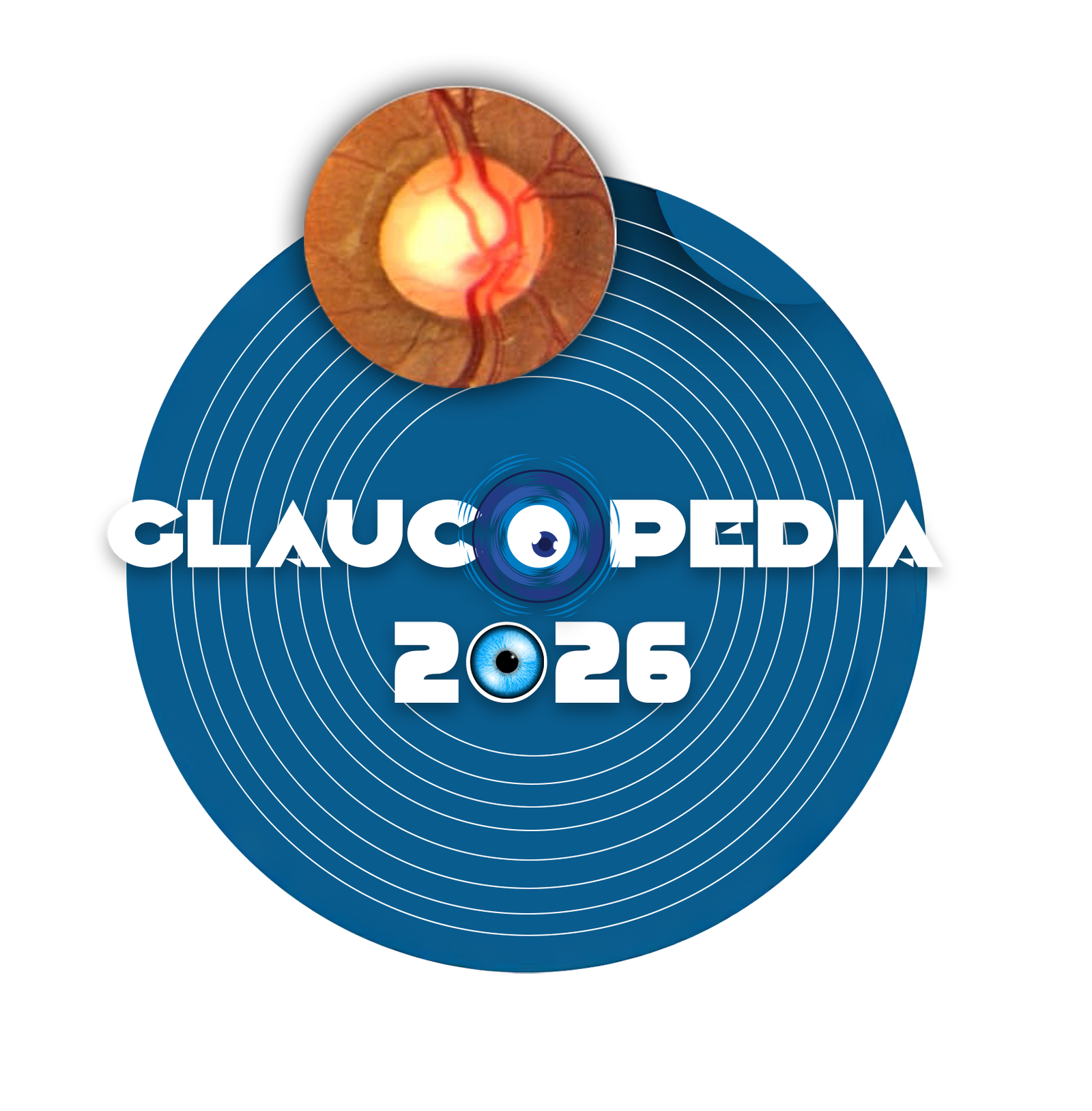 Glaucopedia